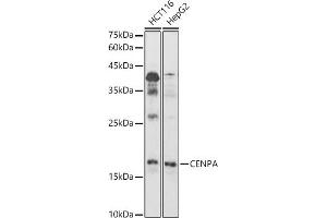 Western blot analysis of extracts of various cell lines, using CENPA antibody (ABIN7266271) at 1:1000 dilution. (CENPA 抗体  (AA 1-100))