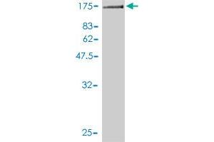Western Blotting (WB) image for anti-General Transcription Factor IIIC, Polypeptide 2, beta 110kDa (GTF3C2) (AA 1-911) antibody (ABIN561183)