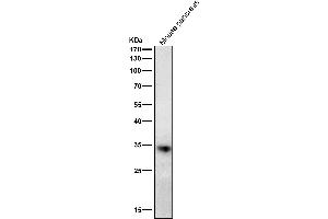 All lanes use the Antibody at 1:2K dilution for 1 hour at room temperature.