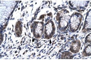 Immunohistochemistry (IHC) image for anti-Hematopoietic Cell-Specific Lyn Substrate 1 (HCLS1) (N-Term) antibody (ABIN2777503)