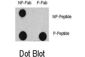 Image no. 1 for anti-Epidermal Growth Factor Receptor (EGFR) (pTyr1125) antibody (ABIN358328) (EGFR 抗体  (pTyr1125))