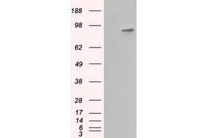 Western Blotting (WB) image for anti-Betaine--Homocysteine S-Methyltransferase (BHMT) antibody (ABIN1496916) (BHMT 抗体)