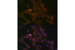 Immunofluorescence analysis of NIH-3T3 cells using PER3 Rabbit mAb (ABIN7269225) at dilution of 1:100 (40x lens). (PER3 抗体)