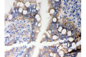 Anti- HLA-A Picoband antibody,IHC(P) IHC(P): Rat Intestine Tissue (HLA-A 抗体  (N-Term))