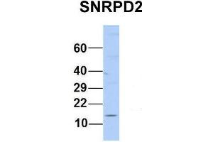 Host:  Rabbit  Target Name:  SNRPD2  Sample Type:  Human MCF7  Antibody Dilution:  1. (SNRPD2 抗体  (N-Term))