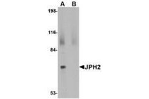 Image no. 1 for anti-Junctophilin 2 (JPH2) (C-Term) antibody (ABIN341698) (Junctophilin 2 抗体  (C-Term))