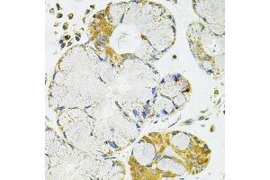 Immunohistochemistry (Paraffin-embedded Sections) (IHC (p)) image for anti-Protein Phosphatase 1, Catalytic Subunit, alpha Isoform (PPP1CA) (AA 1-330) antibody (ABIN6146053)