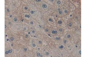 Immunohistochemistry (IHC) image for anti-Glutathione S-Transferase theta 2 (GSTT2) (AA 15-235) antibody (ABIN7432193)