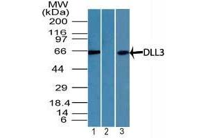 Image no. 1 for anti-delta Like Protein 3 (DLL3) (AA 100-150) antibody (ABIN960134) (DLL3 抗体  (AA 100-150))