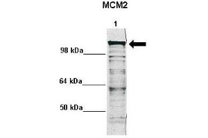 WB Suggested Anti-MCM2 Antibody    Positive Control:  Lane 1: 5ug mouse neural stem cell lysate  Primary Antibody Dilution :   1:1000  Secondary Antibody :  Anti rabbit - IR-dye  Secondry Antibody Dilution :   1:10,000   Submitted by:  Anonymous (MCM2 抗体  (N-Term))