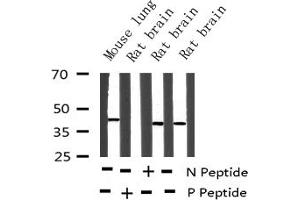 Western blot analysis of Phospho-MEK2 (Thr394) expression in various lysates (MEK2 抗体  (pThr394))