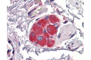 Immunohistochemistry (IHC) image for anti-Zinc Finger Protein 36, C3H Type, Homolog (Mouse) (ZFP36) (AA 257-306) antibody (ABIN6747031)