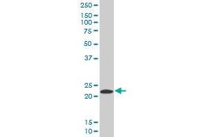 PYCARD MaxPab polyclonal antibody. (PYCARD 抗体  (AA 1-149))