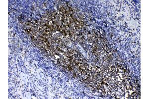 IHC analysis of CD90/Thy1 using anti- CD90/Thy1 antibody . (CD90 抗体  (AA 20-131))