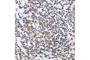 Immunohistochemistry of paraffin-embedded human colon using CSF3 antibody (ABIN6127710, ABIN6139100, ABIN6139101 and ABIN6221772) at dilution of 1:100 (40x lens). (G-CSF 抗体  (AA 30-207))