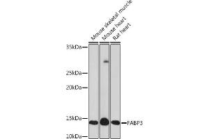 Western blot analysis of extracts of various cell lines, using F Rabbit mAb (ABIN7267152) at 1:1000 dilution. (FABP3 抗体)