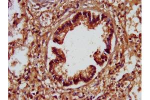 IHC image of ABIN7170440 diluted at 1:200 and staining in paraffin-embedded human lung tissue performed on a Leica BondTM system. (SPTBN1 抗体  (AA 2096-2256))