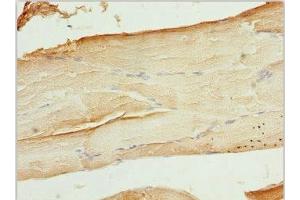 Immunohistochemistry of paraffin-embedded human skeletal muscle tissue using ABIN7175708 at dilution of 1:100 (WIPI2 抗体  (AA 205-454))
