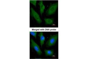 ICC/IF Image Immunofluorescence analysis of paraformaldehyde-fixed HeLa, using SCY1 like 3, antibody at 1:200 dilution. (SCYL3 抗体  (Center))
