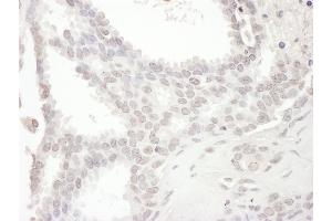 Immunohistochemistry (IHC) image for anti-NCK Interacting Protein with SH3 Domain (NCKIPSD) (AA 672-722) antibody (ABIN7454847) (NCKIPSD 抗体  (AA 672-722))