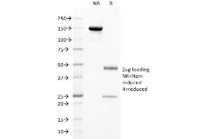 SDS-PAGE Analysis Purified HNF1A Mouse Monoclonal Antibody (HNF1A/2087). (HNF1A 抗体  (AA 214-339))
