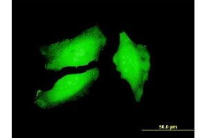 Immunofluorescence (IF) image for anti-Peptidyl Arginine Deiminase, Type IV (PADI4) (AA 2-110) antibody (ABIN525272)