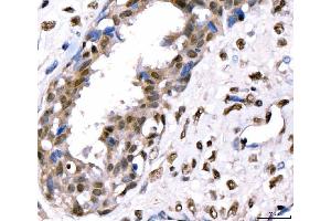IHC analysis of CRTC3 using anti-CRTC3 antibody (ABIN7599779).