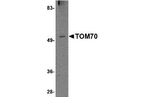 Western Blotting (WB) image for anti-Translocase of Outer Mitochondrial Membrane 70 (TOMM70A) (N-Term) antibody (ABIN1031635) (TOM70 抗体  (N-Term))