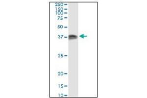 Western Blotting (WB) image for anti-Protein Kinase, Interferon-Inducible Double Stranded RNA Dependent Activator (PRKRA) antibody (ABIN781891)