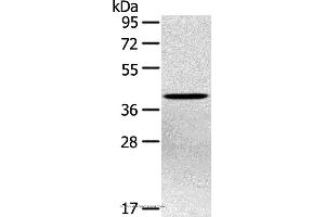Western blot analysis of Hepg2 cell, using PTX3 Polyclonal Antibody at dilution of 1:400 (PTX3 抗体)