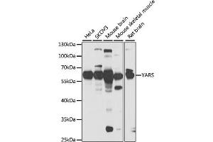 Western blot analysis of extracts of various cell lines, using YARS antibody (ABIN6128883, ABIN6150324, ABIN6150325 and ABIN6222537) at 1:1000 dilution. (YARS 抗体  (AA 1-300))