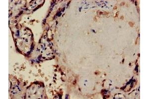 Immunohistochemistry (IHC) image for anti-Protein Phosphatase 1, Catalytic Subunit, alpha Isoform (PPP1CA) (AA 192-330), (Catalytic Subunit) antibody (ABIN7169304)