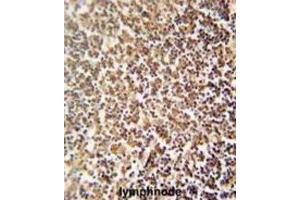 Immunohistochemistry (IHC) image for anti-Zinc Finger Protein 98 (ZNF98) antibody (ABIN2995694) (ZNF98 抗体)