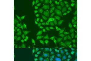 Immunofluorescence analysis of U2OS cells using STAU2 Polyclonal Antibody at dilution of 1:100. (Double-stranded RNA-binding protein Staufen homolog 2 (STAU2) 抗体)