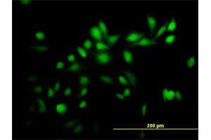 Immunofluorescence (IF) image for anti-Tripartite Motif Containing 39 (TRIM39) (AA 1-488) antibody (ABIN527944)
