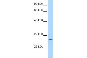WB Suggested Anti-Ywhag Antibody Titration: 1. (14-3-3 gamma 抗体  (N-Term))