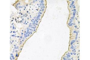 Immunohistochemistry of paraffin-embedded Mouse lung using HPR Polyclonal Antibody at dilution of 1:100 (40x lens). (HPR 抗体)