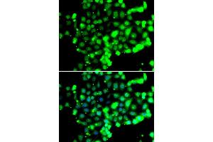 Immunofluorescence analysis of U20S cell using FASTK antibody. (FASTK 抗体)