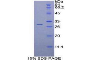 SDS-PAGE analysis of Rat vWA1 Protein. (VWA1 蛋白)