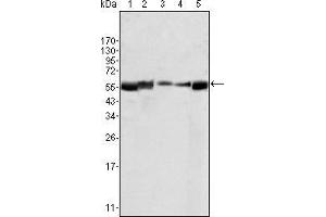 Western blot analysis using LYN mouse mAb agains HL60 (1), L540 (2), SLLP-M2 (3), SEM (4) and Ramos (5) cell lysate. (LYN 抗体)