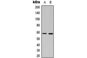 Western blot analysis of Estrogen Receptor 2 expression in COLO205 (A), NIH3T3 (B) whole cell lysates. (ESR2 抗体  (Center))