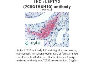 Image no. 1 for anti-Left-Right Determination Factor 2 (LEFTY2) antibody (ABIN1723390) (LEFTY2 抗体)