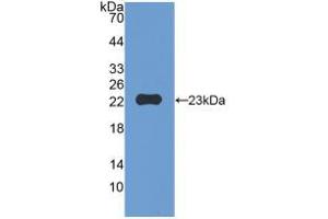 Western blot analysis of recombinant Mouse MMP12. (MMP12 抗体  (AA 294-473))