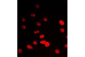 Immunofluorescent analysis of IP6K2 staining in A549 cells. (IP6K2 抗体  (Center))