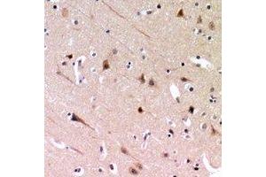Immunohistochemical analysis of ZP2 staining in human brain formalin fixed paraffin embedded tissue section. (ZP2 抗体)