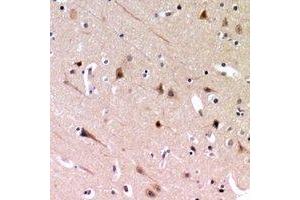 Immunohistochemical analysis of ZP2 staining in human brain formalin fixed paraffin embedded tissue section. (ZP2 抗体)