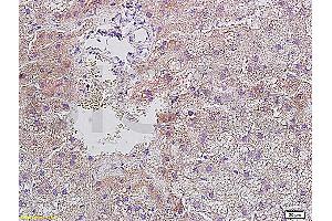 Formalin-fixed and paraffin embedded rat liver tissue with Anti-Resistin Polyclonal Antibody, Unconjugated (ABIN728278) at 1:400, followed by conjugation to the secondary antibody and DAB staining (Resistin 抗体  (AA 21-114))