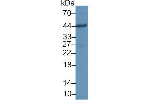 Detection of CD86 in Human Hela cell lysate using Polyclonal Antibody to Cluster Of Differentiation 86 (CD86) (CD86 抗体  (AA 37-272))