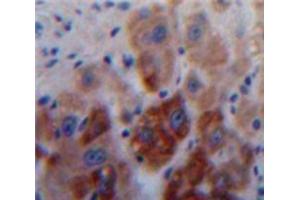 IHC-P analysis of Liver tissue, with DAB staining. (A1BG 抗体  (AA 313-512))