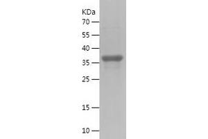 Western Blotting (WB) image for Interleukin 23, alpha subunit p19 (IL23A) (AA 20-157) protein (His-IF2DI Tag) (ABIN7123578)